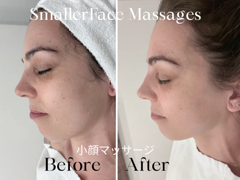 Small face massage before and after — jawline in profile