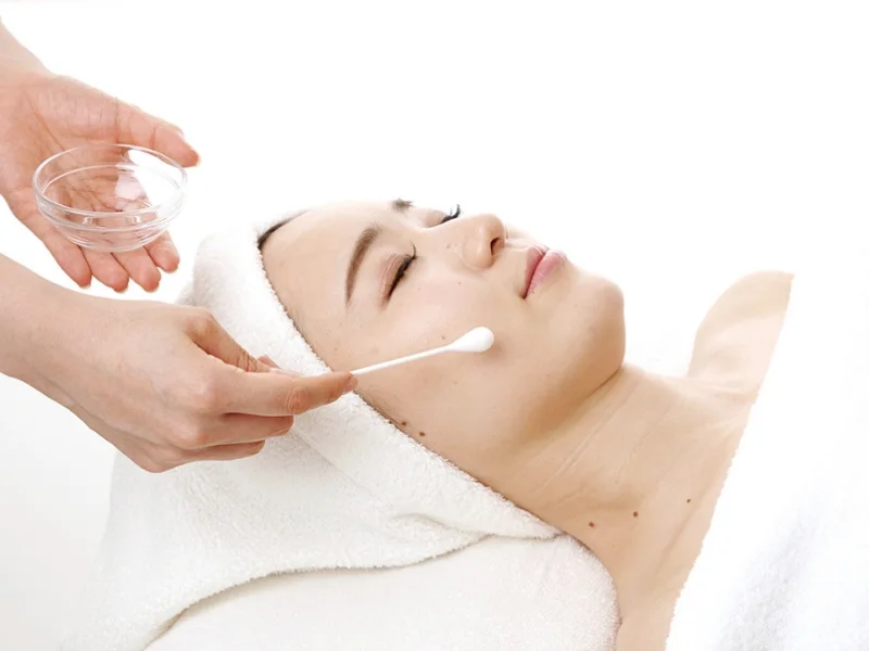 Snow Peel treatment